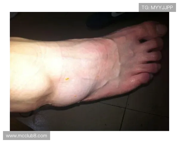 脚踝伤痛困扰足球生涯无奈困境如何应对运动员的伤后恢复挑战